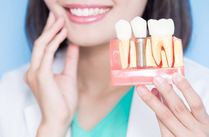 Dental Implants In Turkey