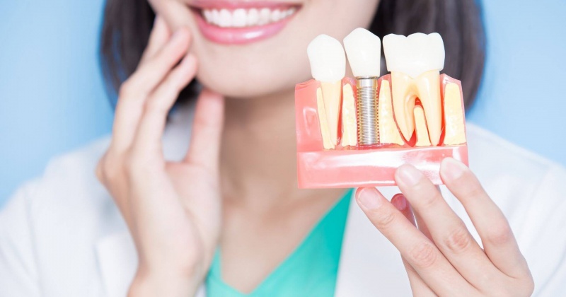 Dental Implants In Turkey